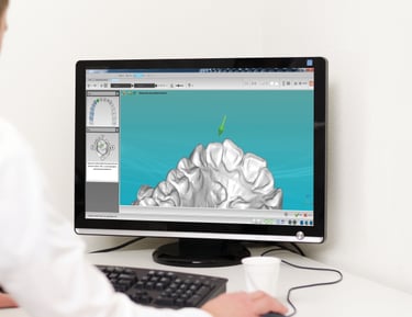 CBCT guided implant treatment planning