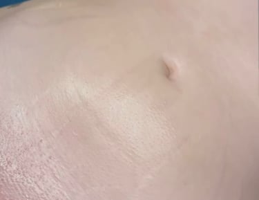 Brazilian or bikini line