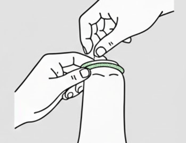 2 hands putting condom on with foreskin