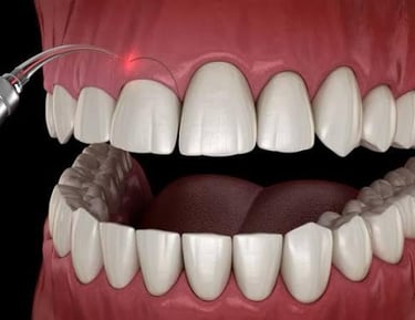 gingivectomy, frenoktomy, curetage