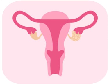 illustration du cycle menstruel-accompagnement diététique des troubles féminins