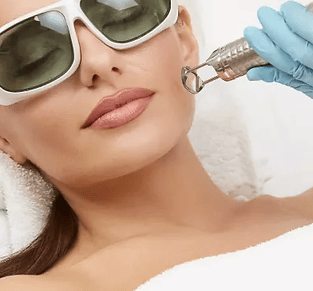 CO2 Fractional Laser