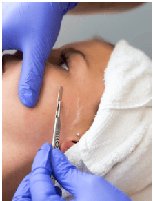 Dermaplaning Facial
