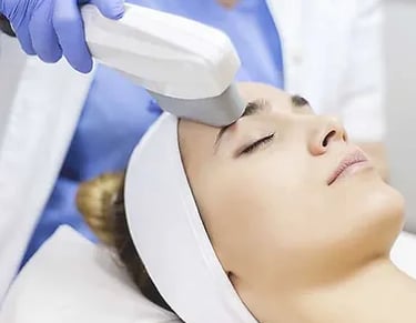 IPL Treatment laser