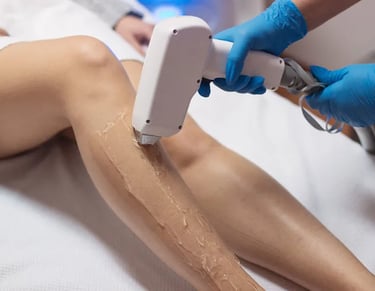 Laser Hair Removal