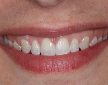 pictures of teeth