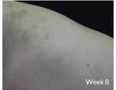 skin 3