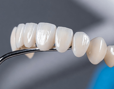 carillas dentales en las palmas de gran canaria