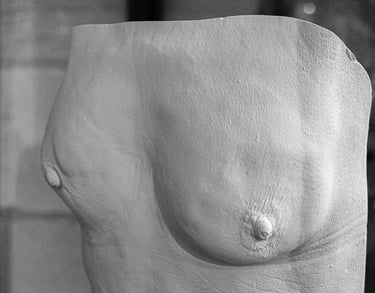 Moulage femme atteinte du cancer du sein