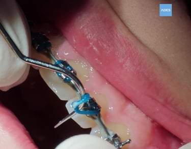 revision ortodoncia clinica dental ades