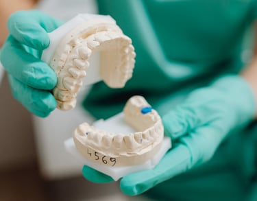 زراعة الأسنان - عيادة طب الاسنان دكتور وسام علي العباسي