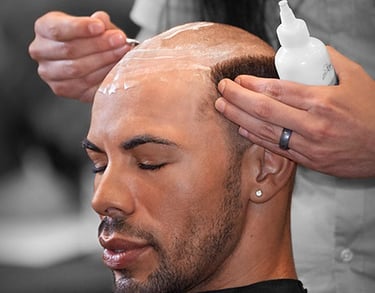 Scalp Micropigmentation in Toronto_ATRUBARBER Scalp Micropigmentation Studio