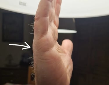 the marriage lines shown on the hand