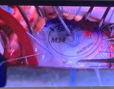 Heart Valve Repair Malta