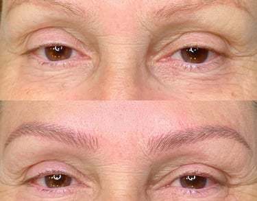 a woman with a large forehead and eyebrows nanoblanding
