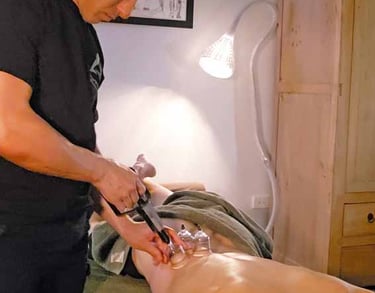 Wollongong therapist performing cupping on a males lower back 