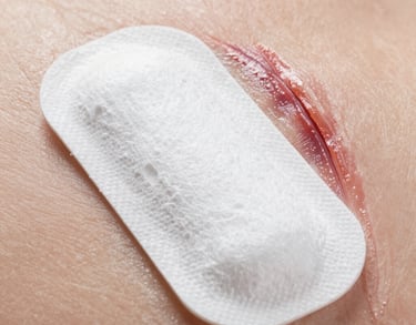 a man riding a skateboard down the side of a ramp