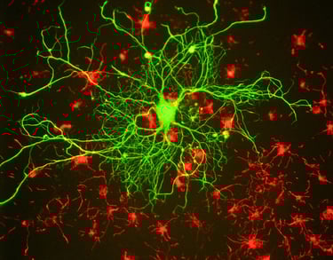 Neurons