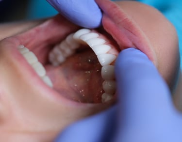 فحص ومعاينة الأسنان - عيادة طب الاسنان دكتور وسام علي 