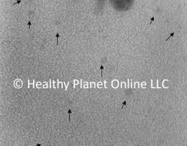 test image showing results of 1nm to 2nm particle size in process that included agitating the water