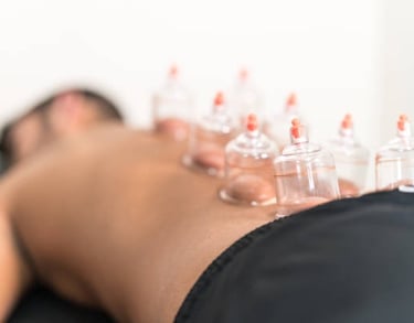 ventosaterapia ventosas, alivio de dor