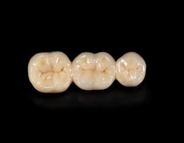 dental bridge greenville sc