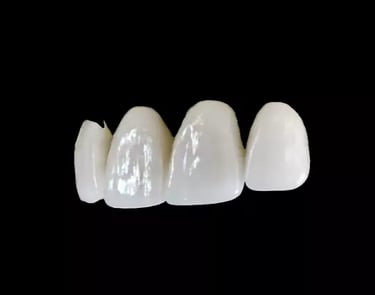 veneers crowns bridges bondings