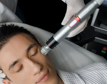 a man getting a laser treatment from a woman