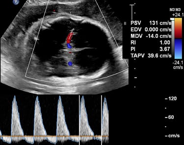 Ultrasound image of fetal brain with color Doppler for hands-on training class.