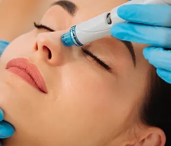 Laser skin rejuvenation