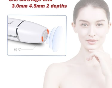 4D Radar carving treatment laser