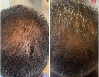 Before and after of man hair thicker