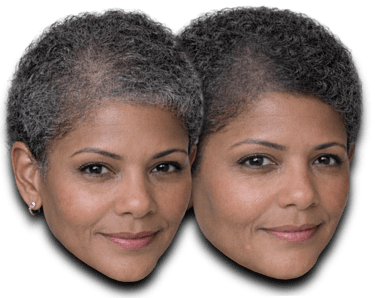 a before/after photo of a woman who has received an SMP treatment on her scalp