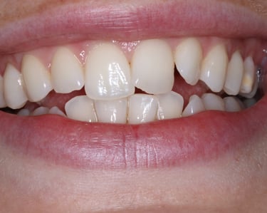 pictures of teeth