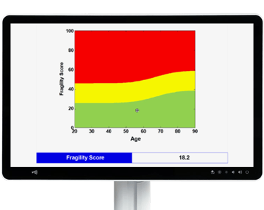 Echolight Fragility Score report used to assess fracture risk