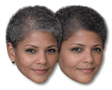 Before-and-after of a man's scalp micropigmentation, showing a fuller, denser hair look for hair loss solutions.