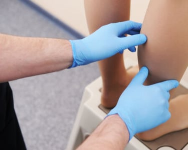 vascular ultrasound vein bypass graft mapping artery blockage occlusion surgery superficial leg arm pain walking ache calf