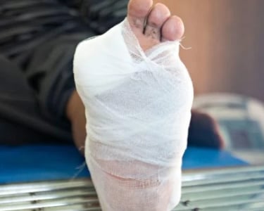 Diabetic Wound Care At home 