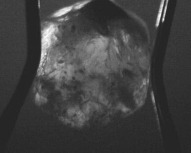 Darkfield Image of a sapphire