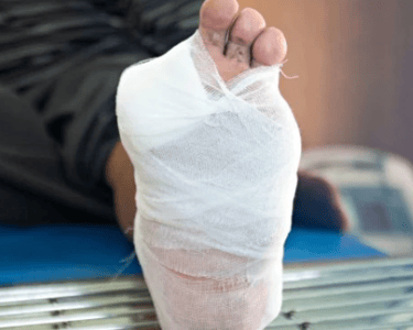 Diabetic Wound Care At home 