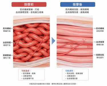 左邊：緊繃打結的肌肉纖維（紅色區域） 右邊：按摩後鬆開的肌肉纖維（顏色變淡、線條變順）