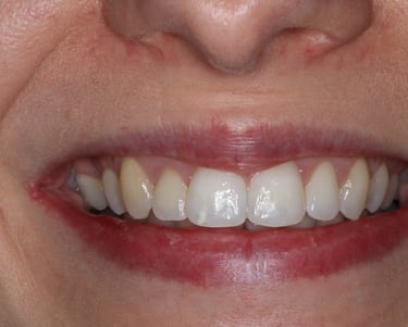 pictures of teeth