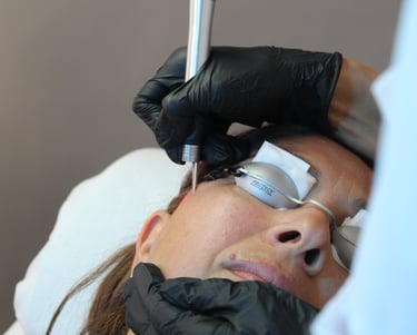 Glass Skin behandling hos Skin Room.