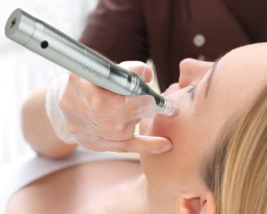dermapen microneedling
