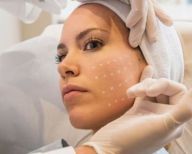 Mesoterapia Facial