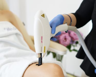 laser vascular para arañitas