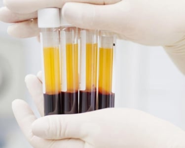 PRP Plasma Rico en Plaquetas