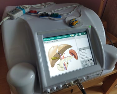 Rayonex Polar et organes
