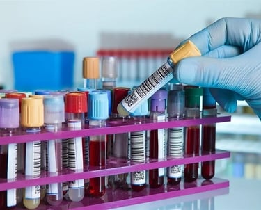 Autoimmune disease state samples