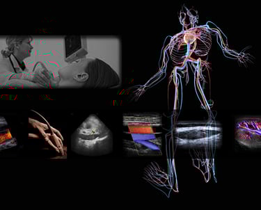 Vascular ultrasound Doppler technique practice.